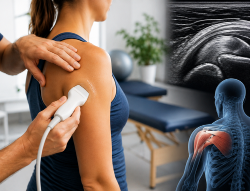 Fysiotherapie bij schouderklachten in Haarlem